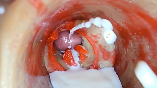 Camera Inside Deep Pussy trifle Captures dose Ejaculation of Sperm